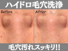 ストリクス(STRIX)