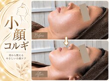 サナグレース(SanaGrace)の雰囲気（骨格から整える小顔コルギ☆フェイスラインを美しく引き締めます）