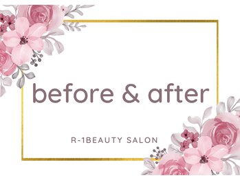 R-1ビューティーサロン 表参道/Before&After
