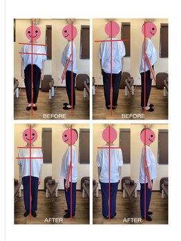 やまな整骨院/肩の高さ・前傾・巻き肩