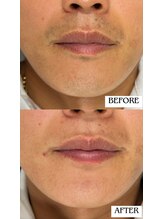 バディーズ(BUDDieS)/30代