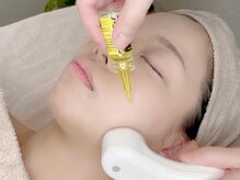 ラルミエール 緑店はなれ(la lumiere)の雰囲気（韓国発の最新脂肪分解液を使用し二重顎など小顔効に大！）