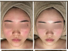 KANコルギセラピー 群馬高崎店/