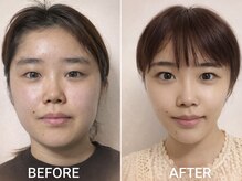 ゴールデンケア(goldencare)の雰囲気（顔が一回り小顔に、フェイスラインのVライン注目!お悩み解決速攻）