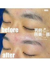 男前倶楽部/脱毛/メンズ脱毛/メンズ専門店