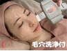 大人気！お顔脱毛体験　毛穴洗浄付き　　11,550円→5,550円