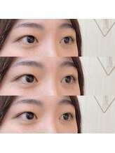 シアミス(SIAMIHS)/トリートメント