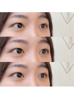 シアミス(SIAMIHS)/トリートメント