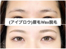 アンベリイルラッシュ(Embellir Lash)/アイブロウ眉毛ワックス脱毛