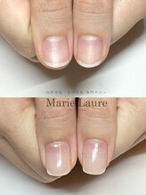 マリーロール 淀屋橋本店(Marie Laure)/自爪育成/深爪矯正/ネイルケア
