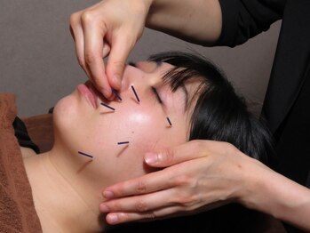 きわみ鍼灸整骨院 博多院/【博多駅】肌質改善/スキンケア