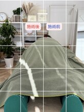 ルミナフローム(LuminaFlowm)/もともとその位置