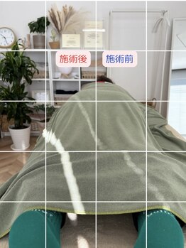 ルミナフローム(LuminaFlowm)/もともとその位置