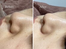 エリー(Ellie)/柔らかそうな、女性らしい肌