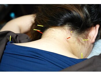 国際通りの朗らか鍼灸院