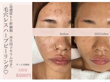 ムニ  福島 野田(muni)の雰囲気（【ヒト幹細胞美容液付き】ダウンタイム/剥離なし/透明感爆上がり）
