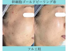 リメイククリニカルビューティー(Remake clinical beauty)/