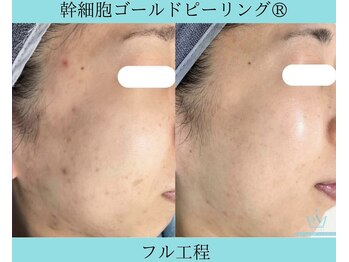 リメイククリニカルビューティー(Remake clinical beauty)/