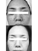 サロンドウルス(salon de ours)/先進美容