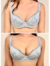 スマイルクルー(SmileClue)/ビフォーアフター症例