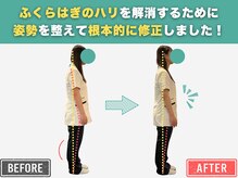 岡山整体 リソル(Resol)/施術 Before→After