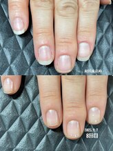 クーラ アンド ベリッシモ(Cura&Bellissimo)/縦長が理想！