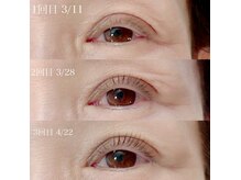 アイビー 姫路店(eyebee)の雰囲気（オーガニック大国イタリアの商材を使用。9種類有効成分で育てる）