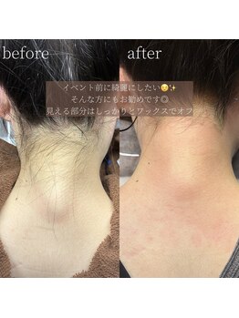 コモレビ(komorebi)/