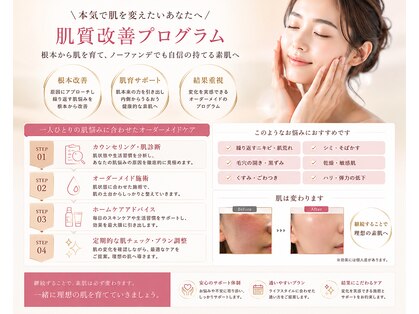 リスール(Re’seule)の写真
