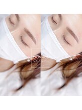 リヨン(LYON+831)/