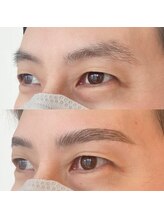 ビーヒアナウ(BE HERE NOW N 03)/ハリウッドブロウリフト