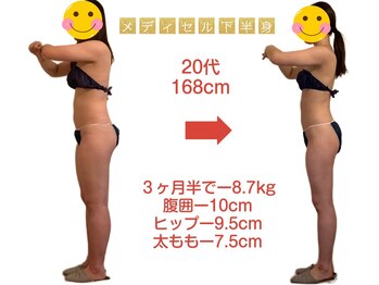 トータルボディケア ナゴミ 六条本店(和)/20代メディセル＋食事＆栄養指導