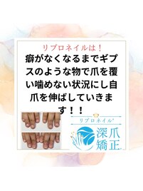 噛む癖、むしる癖