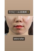 サロン ナビ(salon nabi.)/ララピールbefore→after♪
