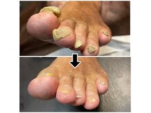 フットレスキュー(Foot ResQ)の雰囲気（自分では難しいケアなどご相談ください！）