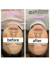 了鍼灸整骨院/お客様before→after