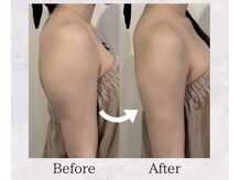 ウナ デ リンゴル 恵比寿店(UNA de Ringol)/ボディ痩身¥18,000