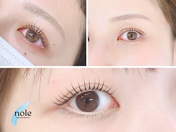 ノーレ 阿倍野 昭和町(nole)