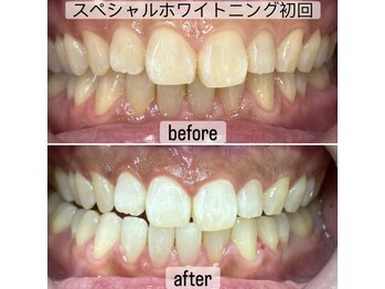 ヤット 森ノ宮(yatto.)/40代男性