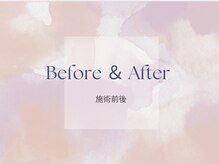 サロン ド ソワ(Salon de Soie)/before ＆ after