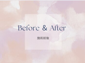 サロン ド ソワ(Salon de Soie)/before ＆ after