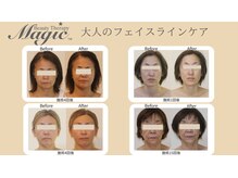 ビューティーセラピーマジック 自由が丘店(Beauty Therapy Magic)