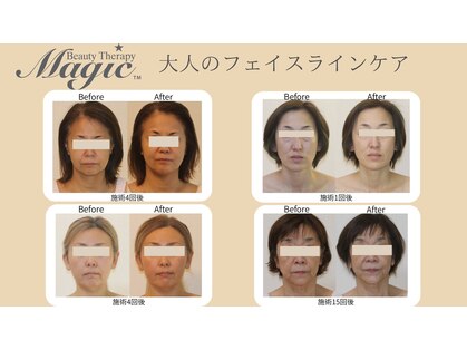 ビューティーセラピーマジック 自由が丘店(Beauty Therapy Magic)の写真