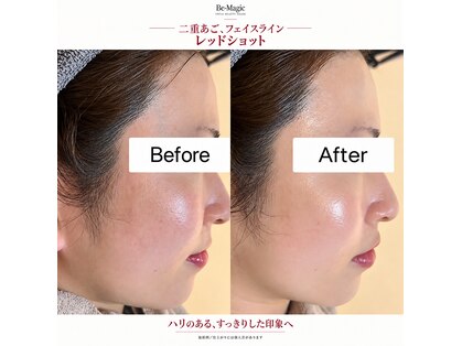 ビーマジック(Be Magic)の写真