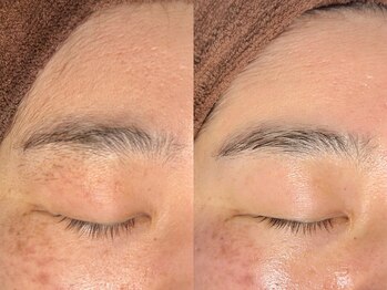 ルーナジェーナ(Luna llena)/池袋 エステ ルーナジェーナ