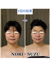 ノリスズ(NORI SUZU)/頬骨下がり面長/エラ/ほうれい線