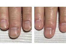オズ ネイルアンドアイ(OZ NAIL&EYE)/ネイルケアで見違える手元に