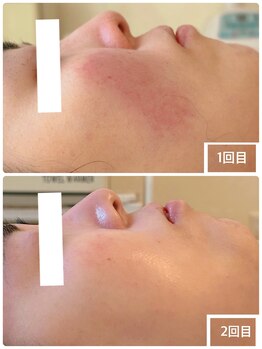 スリムアンドビューティー メゾン ド シュシュ(Slim&Beauty Maison de chouchou)/韓国NO1ララピール