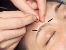 ビハダ(BIHADA)/辛い眼精疲労にも！