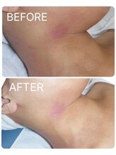 カノン(KANON)/グリーンピール